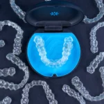 Aparat Invisalign Warszawa