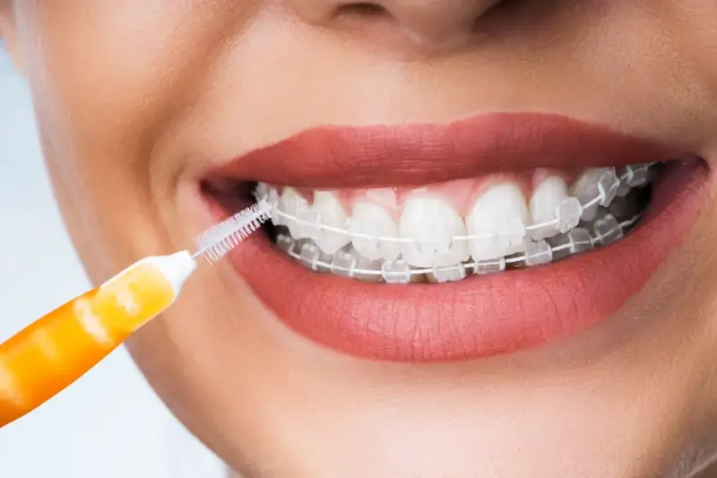 Chirurgia stomatologiczna Szczecin