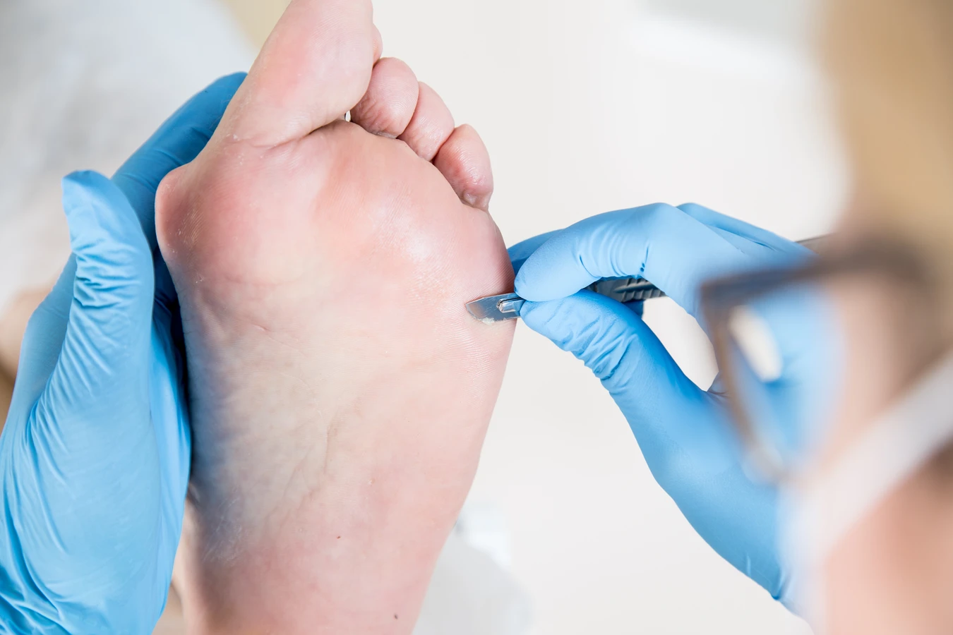  Czym jest pedicure leczniczy oraz na czym dokładnie polega?