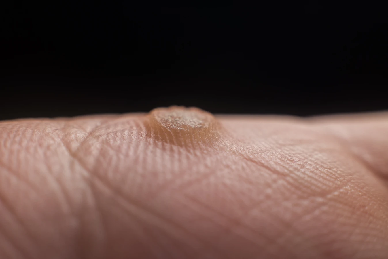 Kompleksowy przewodnik po podologii – co trzeba o niej wiedzieć?